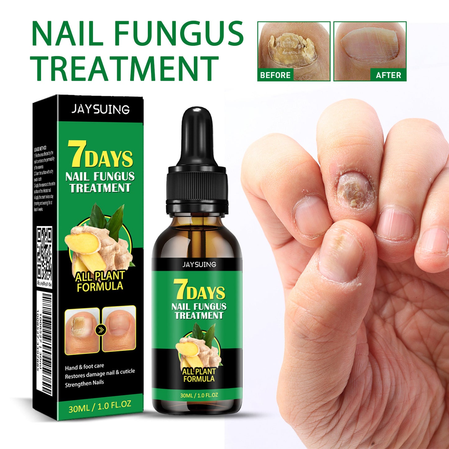 Ginger Nail Care