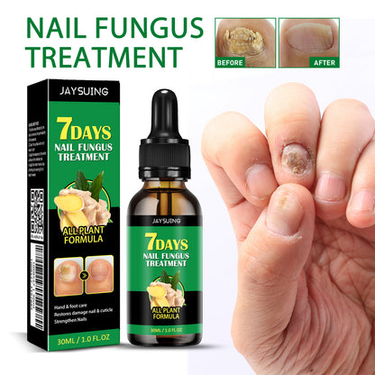 Ginger Nail Care