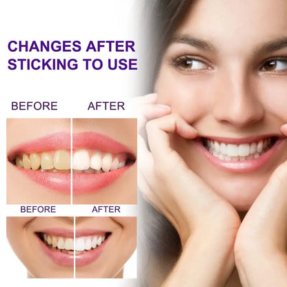 Optical Tooth Brightening Foam via Advanced Colour-Correction Technology