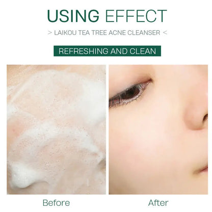 Tea Tree Facial Cleanser - Moisturizing & Cleansing