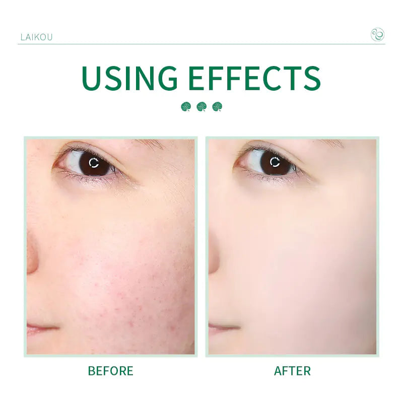 Centella Asiatica Whitening Soothing Facial Cleanser