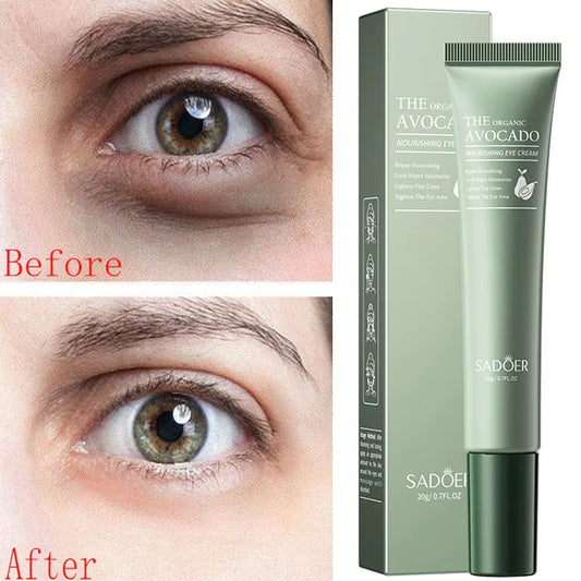 Avocado Essence Nourishing Eye Cream – Multi-Concern Periocular Treatment