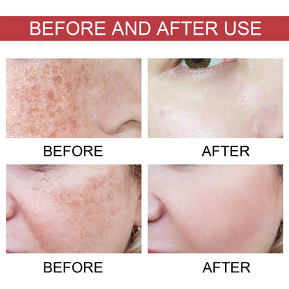 Pure Glow Skin Dark Spot Correcting Serum