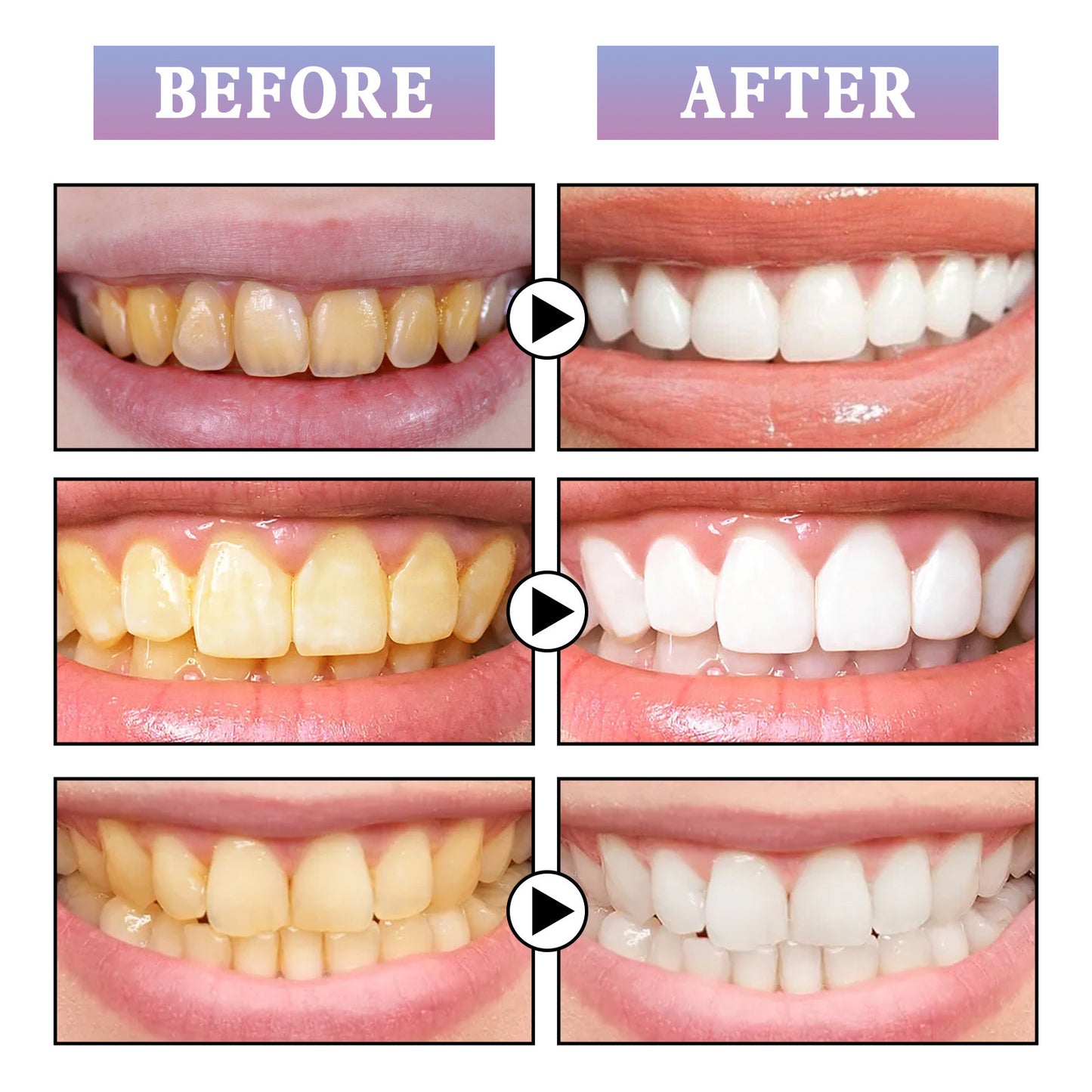 Whitening Toothbrush Pen