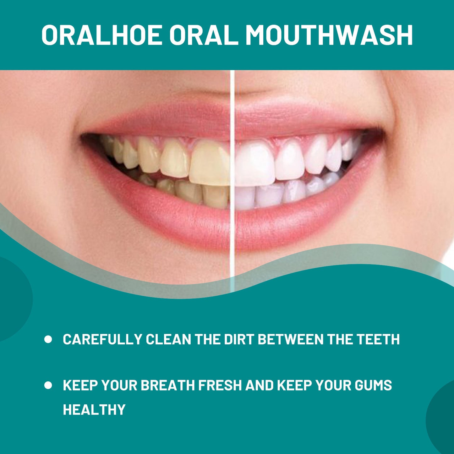Oral Cleaning Mousse