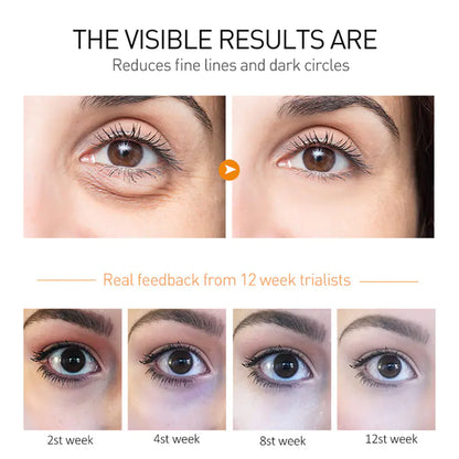 Avocado Essence Nourishing Eye Cream – Multi-Concern Periocular Treatment