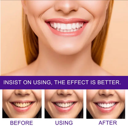 Optical Tooth Brightening Foam via Advanced Colour-Correction Technology