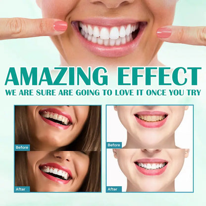 Advanced Foaming Technology Whitening Toothpaste